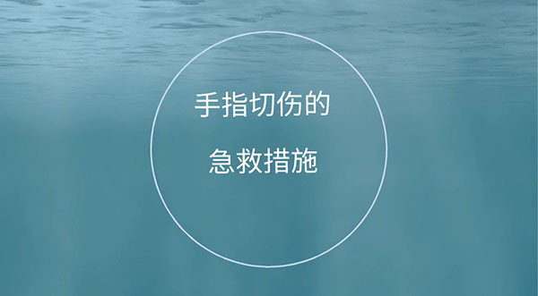 曹艳华——手指切伤的急救措施