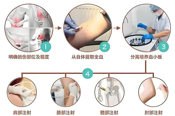 细胞生物治疗专科