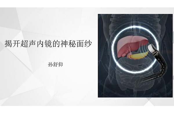 超声内镜